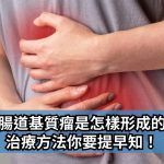 《GreatDoctor》報導：胃腸道基質瘤是怎樣形成的？治療方法你要提早知！
