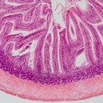 腸化生能無創治療？內視鏡黏膜下剝離術的3大好處！