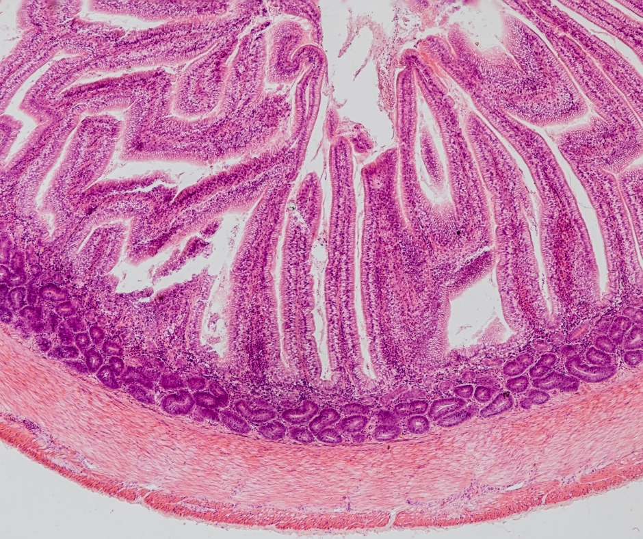 腸化生能無創治療？內視鏡黏膜下剝離術的3大好處！